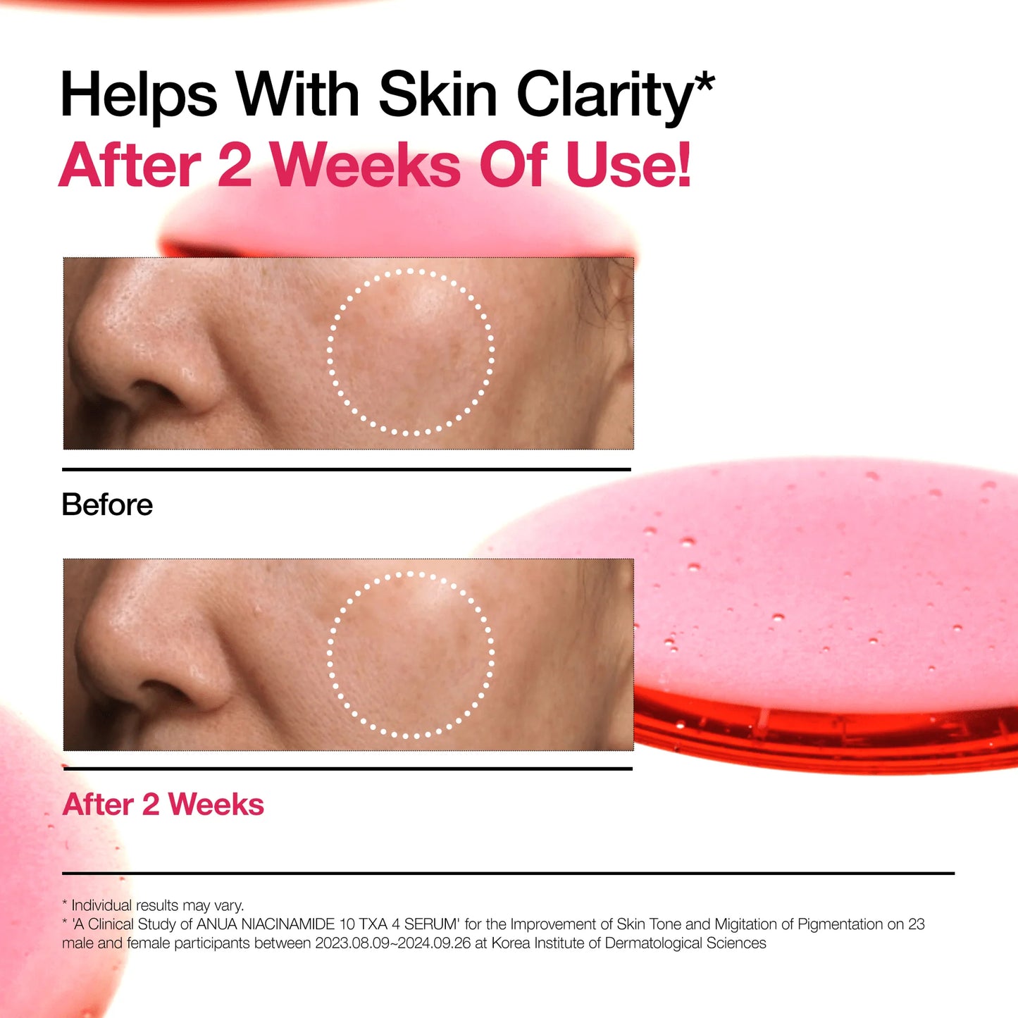 Anua Serum